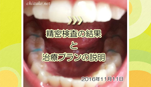 歯列矯正-精密検査の結果と治療プランの説明 20161111