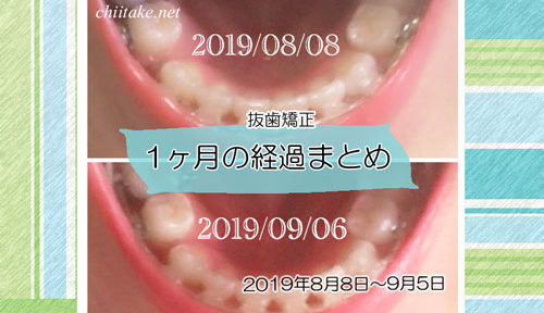 インプラント矯正 歯の動き経過まとめ 20190808-20190905