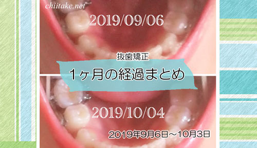 インプラント矯正 歯の動き経過まとめ 20190906-20191003