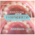 インプラント矯正 歯の動き経過まとめ 20191004-20191031