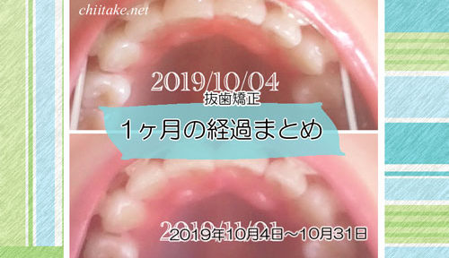 インプラント矯正 歯の動き経過まとめ 20191004-20191031