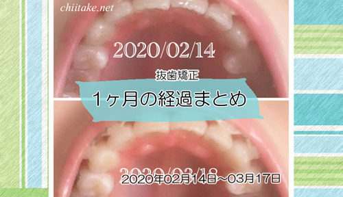 インプラント矯正 歯の動き経過まとめ 20200214-20200317