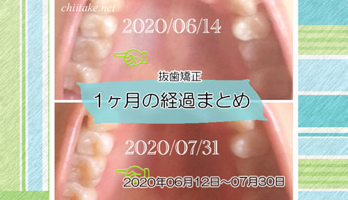 インプラント矯正 歯の動き経過まとめ 20200611-20200730