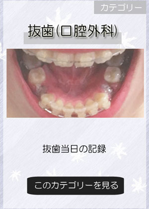 歯列矯正_抜歯・顎関節症の記録